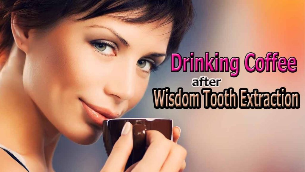 how long after zoom whitening can i drink coffee