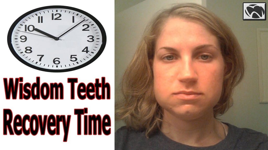 How Long Does It Take To Heal From Wisdom Teeth Removal