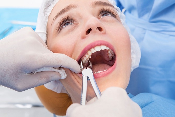How Long Is Wisdom Teeth Surgery – Boston Dentist – Congress Dental