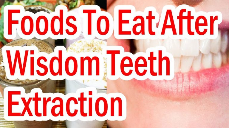 what not to eat after zoom teeth whitening