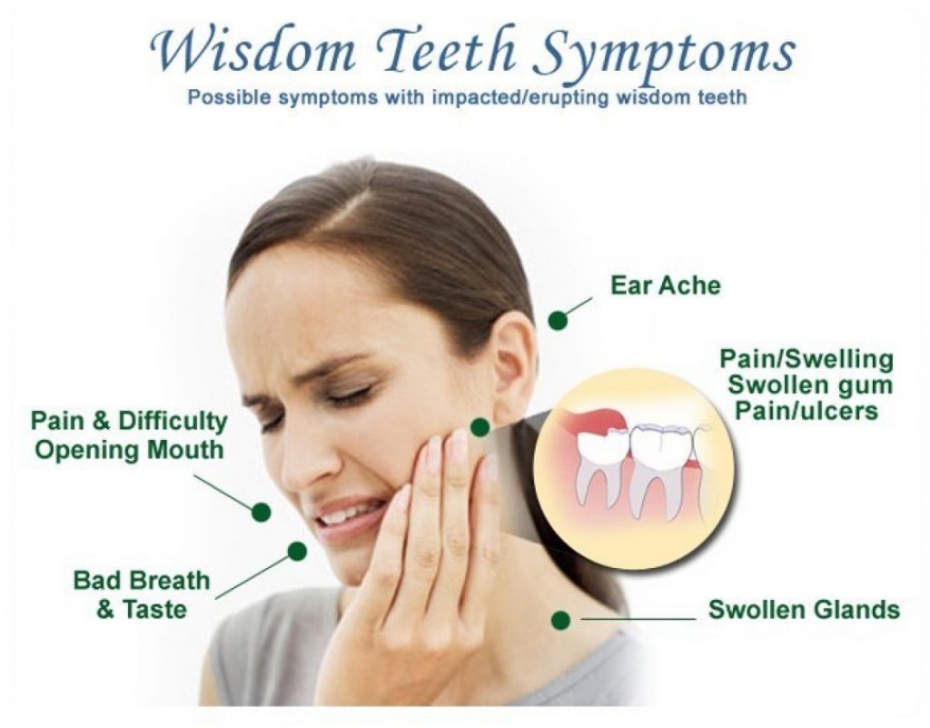 Is Wisdom Teeth Removal Painful Boston Dentist Congress Dental Group Federal St Floor
